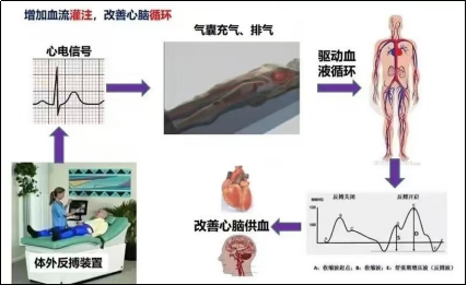 体外反博--躺在床上的有氧运动