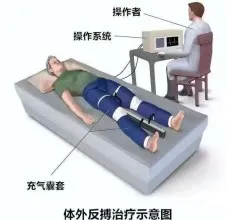 成都青城山医院-体外反搏治疗为您的血管健康守好防线
